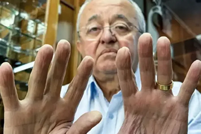 Kastamonu’da 58 Yıllık Gözlükçünün Parmak İzleri “Silindi”